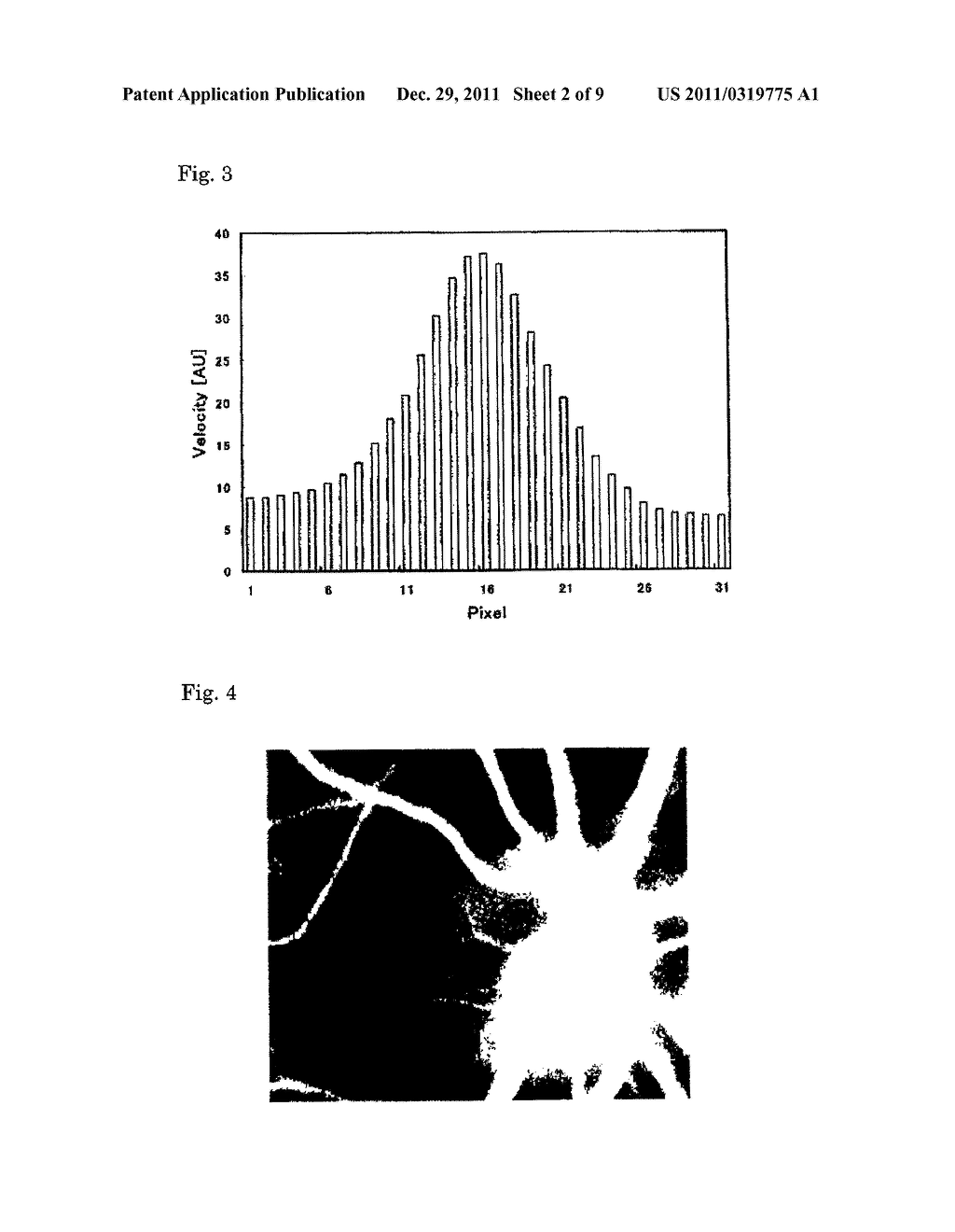 BLOOD FLOW IMAGE DIAGNOSING DEVICE - diagram, schematic, and image 03