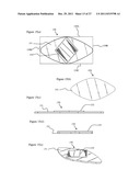 WOUND AND BANDAGE PROTECTION SYSTEM AND METHOD diagram and image