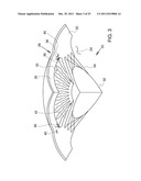 Ocular Implants Deployed in Schlemm s Canal of the Eye diagram and image