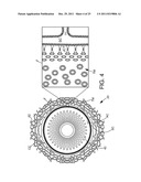 Ocular Implants Deployed in Schlemm s Canal of the Eye diagram and image