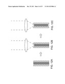 Ocular Implants Deployed in Schlemm s Canal of the Eye diagram and image