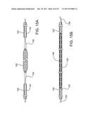 Ocular Implants Deployed in Schlemm s Canal of the Eye diagram and image