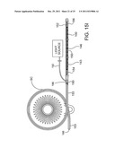 Ocular Implants Deployed in Schlemm s Canal of the Eye diagram and image