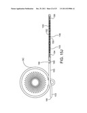 Ocular Implants Deployed in Schlemm s Canal of the Eye diagram and image