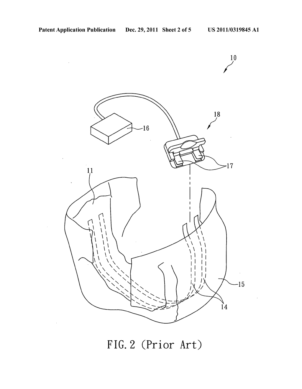 Diaper structure with urine sensor - diagram, schematic, and image 03