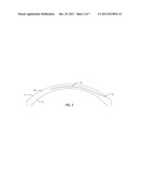 Method for Laser Cutting a Corneal Pocket diagram and image