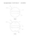 Method for Laser Cutting a Corneal Pocket diagram and image