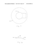 Method for Laser Cutting a Corneal Pocket diagram and image