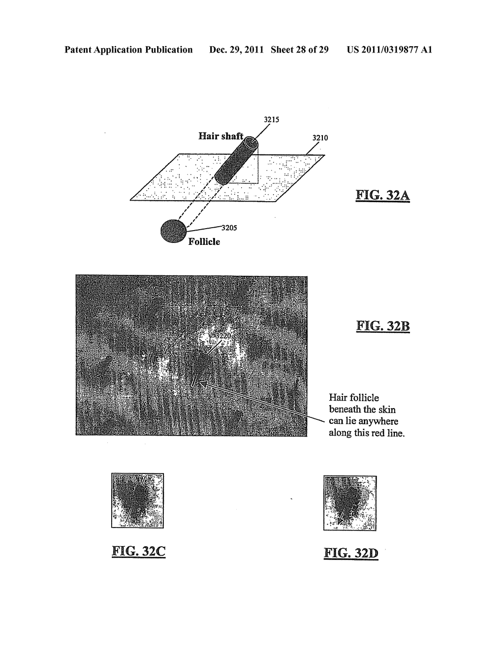 APPARATUS AND METHOD FOR LASER TREATMENT WITH SPECTROSCOPIC FEEDBACK - diagram, schematic, and image 29