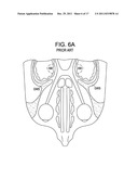 Red Light Implants for Treating Postpartum Depression diagram and image