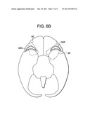 Red Light Implants for Treating Postpartum Depression diagram and image