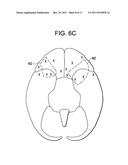 Red Light Implants for Treating Postpartum Depression diagram and image