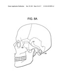 Red Light Implants for Treating Postpartum Depression diagram and image