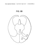 Red Light Implants for Treating Postpartum Depression diagram and image