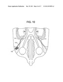 Red Light Implants for Treating Postpartum Depression diagram and image