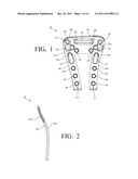 PLATE SYSTEM FOR MANAGING A BONE FRACTURE diagram and image