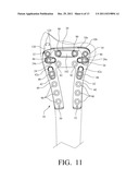 PLATE SYSTEM FOR MANAGING A BONE FRACTURE diagram and image