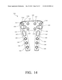 PLATE SYSTEM FOR MANAGING A BONE FRACTURE diagram and image