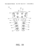 PLATE SYSTEM FOR MANAGING A BONE FRACTURE diagram and image