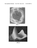 Patient Selectable Joint Arthroplasty Devices and Surgical Tools diagram and image