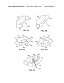 Patient Selectable Joint Arthroplasty Devices and Surgical Tools diagram and image