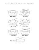 Patient Selectable Joint Arthroplasty Devices and Surgical Tools diagram and image