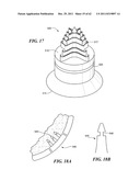 Patient Selectable Joint Arthroplasty Devices and Surgical Tools diagram and image