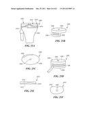 Patient Selectable Joint Arthroplasty Devices and Surgical Tools diagram and image