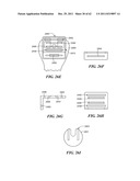 Patient Selectable Joint Arthroplasty Devices and Surgical Tools diagram and image