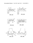 Patient Selectable Joint Arthroplasty Devices and Surgical Tools diagram and image