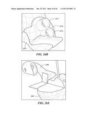 Patient Selectable Joint Arthroplasty Devices and Surgical Tools diagram and image