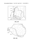 Patient Selectable Joint Arthroplasty Devices and Surgical Tools diagram and image