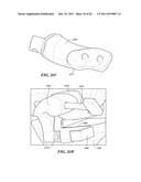 Patient Selectable Joint Arthroplasty Devices and Surgical Tools diagram and image