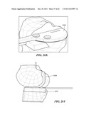 Patient Selectable Joint Arthroplasty Devices and Surgical Tools diagram and image