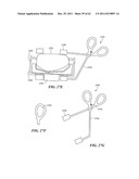 Patient Selectable Joint Arthroplasty Devices and Surgical Tools diagram and image