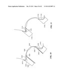 Patient Selectable Joint Arthroplasty Devices and Surgical Tools diagram and image