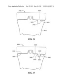 Patient Selectable Joint Arthroplasty Devices and Surgical Tools diagram and image