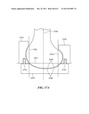 Patient Selectable Joint Arthroplasty Devices and Surgical Tools diagram and image