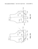 Patient Selectable Joint Arthroplasty Devices and Surgical Tools diagram and image