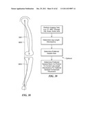 Patient Selectable Joint Arthroplasty Devices and Surgical Tools diagram and image