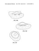 Patient Selectable Joint Arthroplasty Devices and Surgical Tools diagram and image