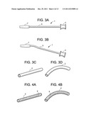 Instruments and Methods for Non-Parallel Disc Space Preparation diagram and image