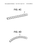 Instruments and Methods for Non-Parallel Disc Space Preparation diagram and image