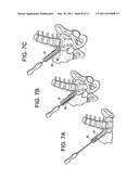 Instruments and Methods for Non-Parallel Disc Space Preparation diagram and image