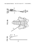 Instruments and Methods for Non-Parallel Disc Space Preparation diagram and image