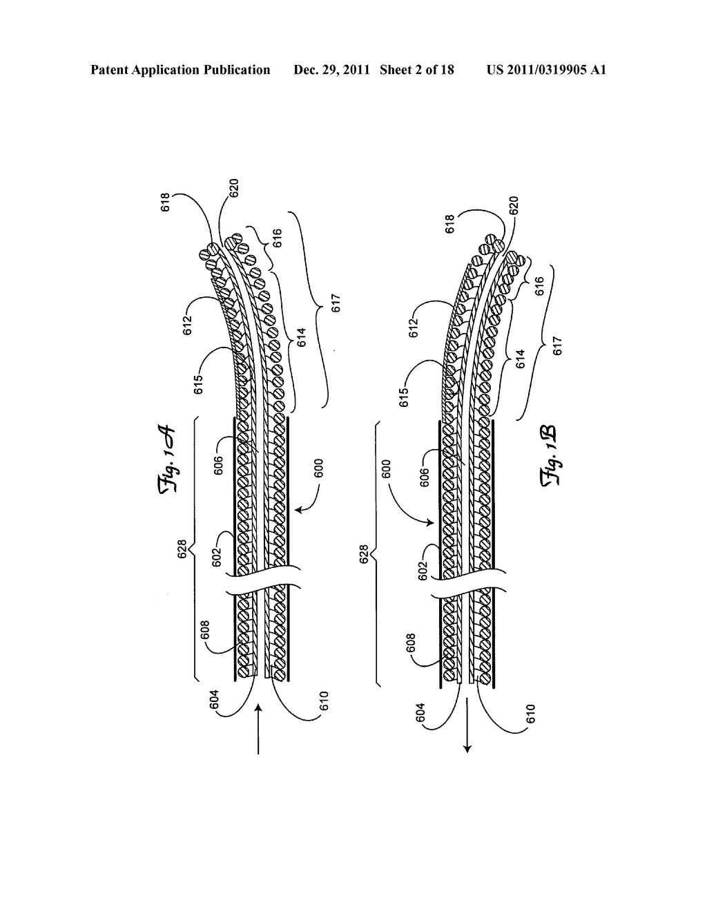 Multiple function vascular device - diagram, schematic, and image 03