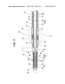 BALLOON CATHETER diagram and image