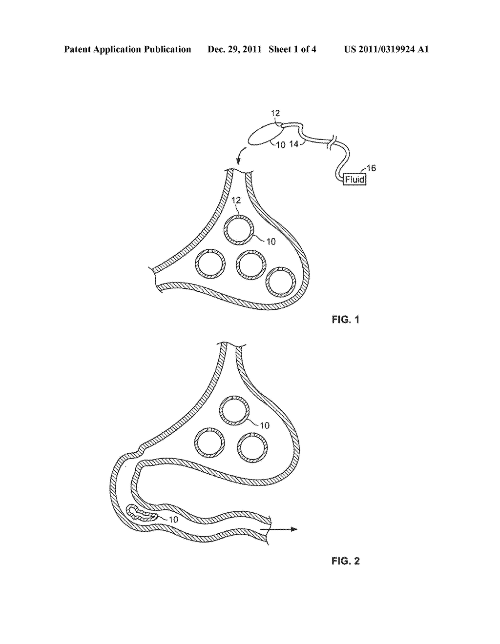 Gastric Space Occupier Systems And Methods Of Use - diagram, schematic, and image 02