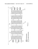 Sacrificial Anode Stent System diagram and image