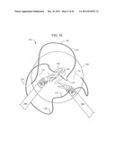 BIDIRECTIONAL SELF-RETAINING SUTURES WITH LASER-MARKED AND/OR NON-LASER     MARKED INDICIA AND METHODS diagram and image